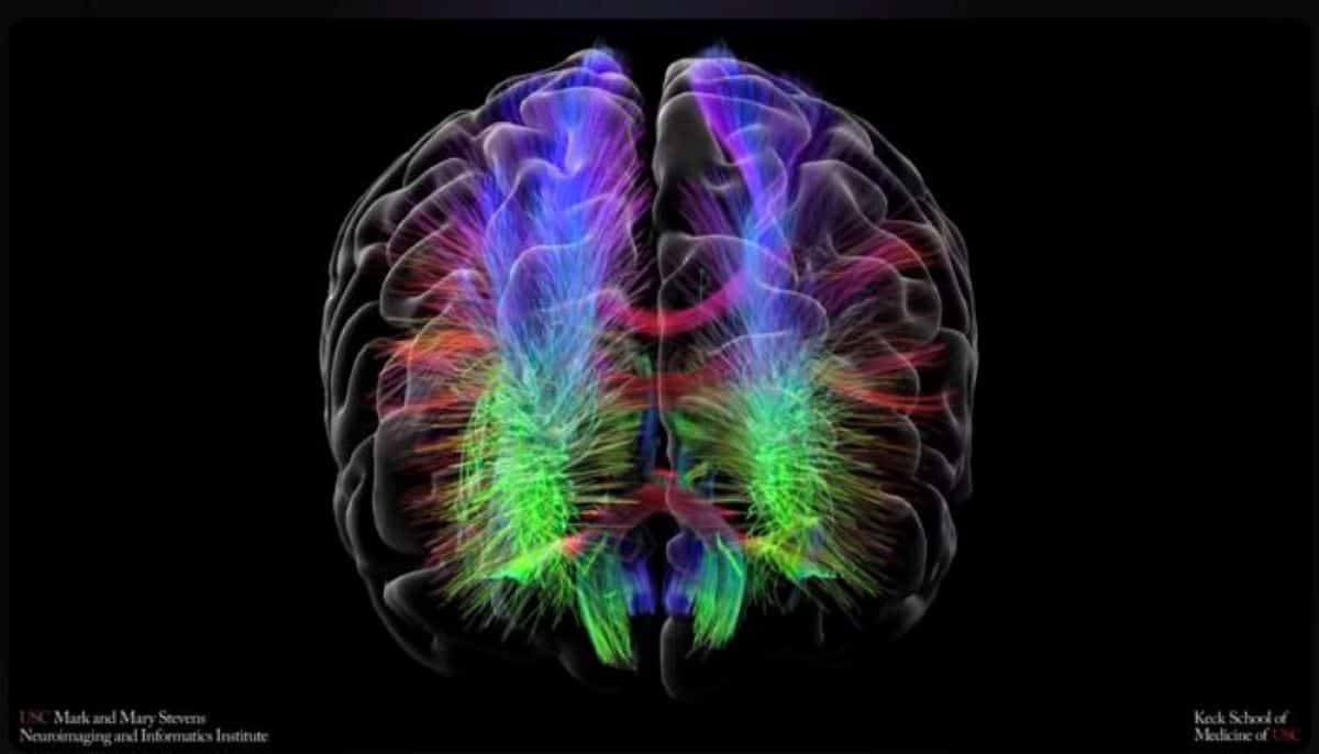 This shows a brain scan from the study.