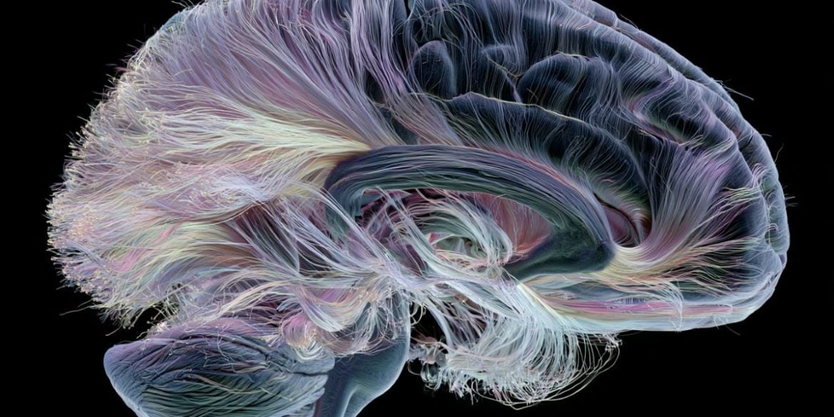 This shows a brain.