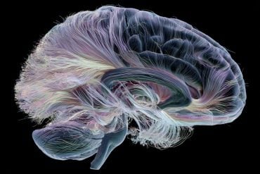 This shows a brain.