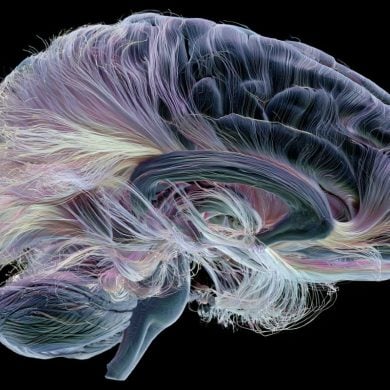 This shows a brain.