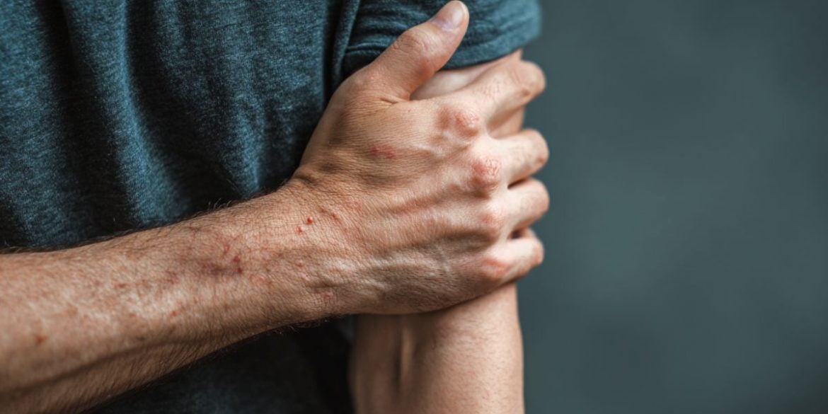 This shows a person scratching their arm.