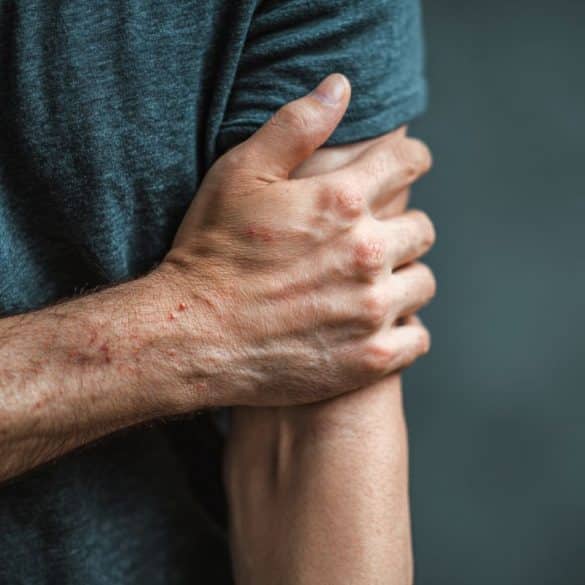 This shows a person scratching their arm.