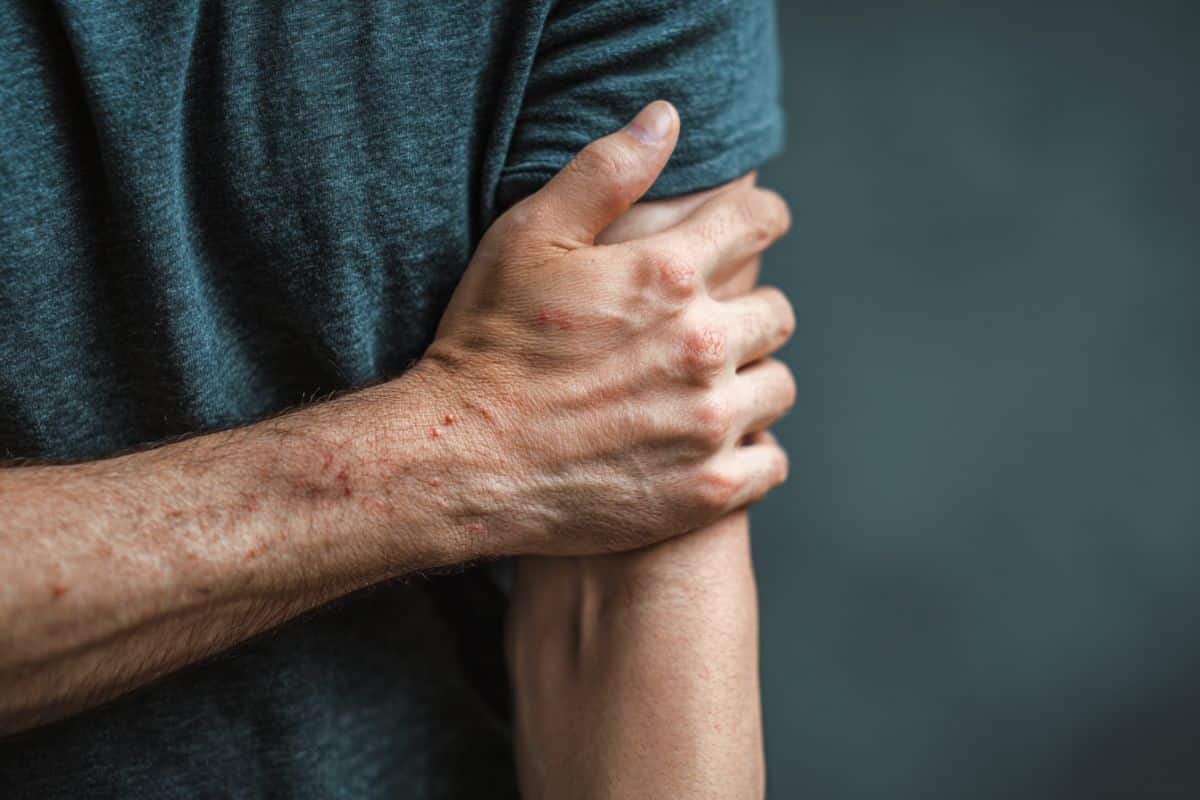 This shows a person scratching their arm.