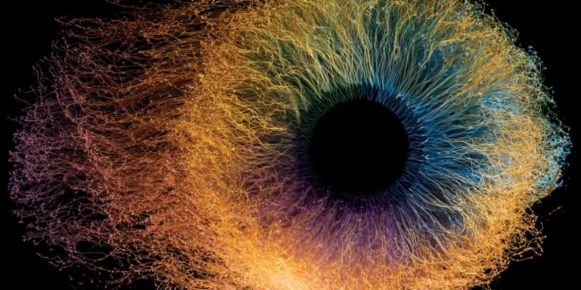 This shows a colorful eye.