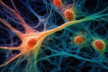 This shows neurons.