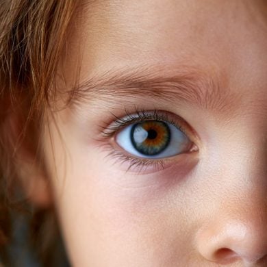 This shows a child's eyes.