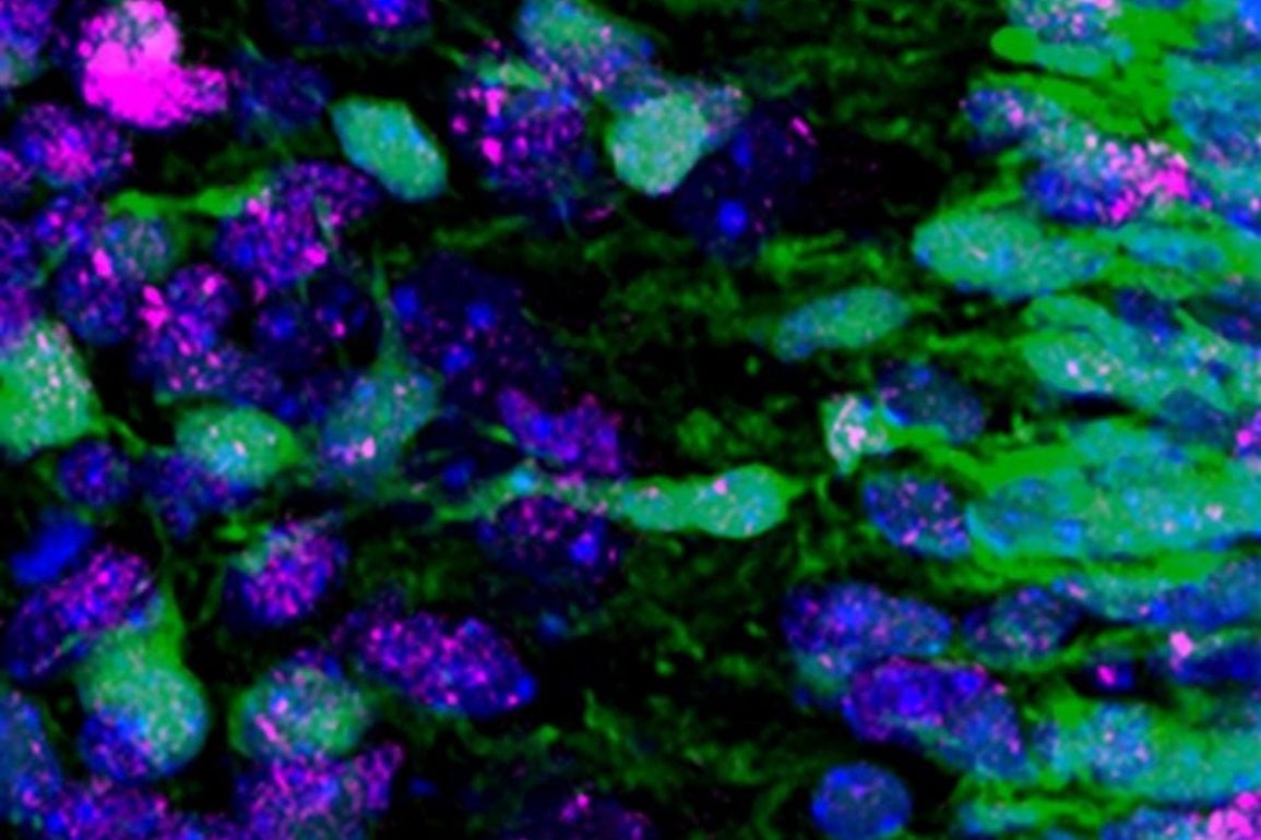 Migrating Nerve Cells Experience Routine, Repairable DNA Damage