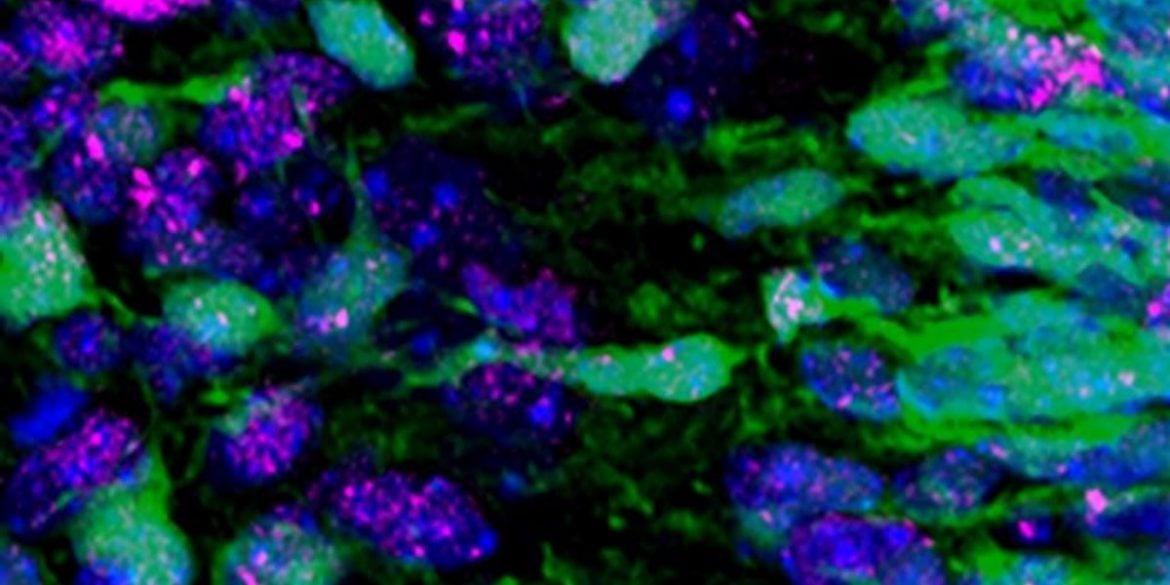 This shows neurons.