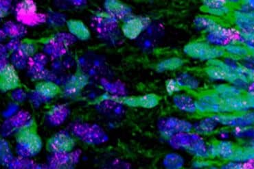 This shows neurons.