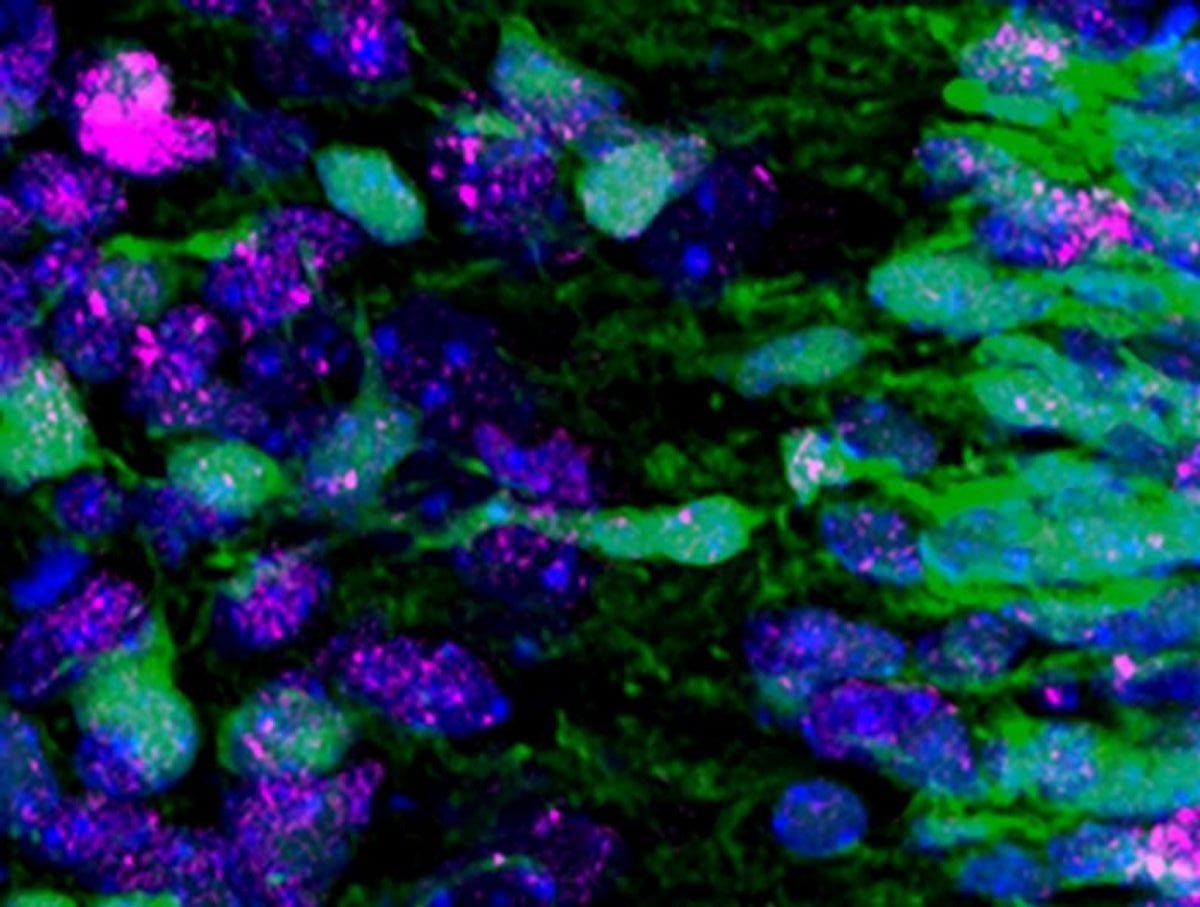 This shows neurons.