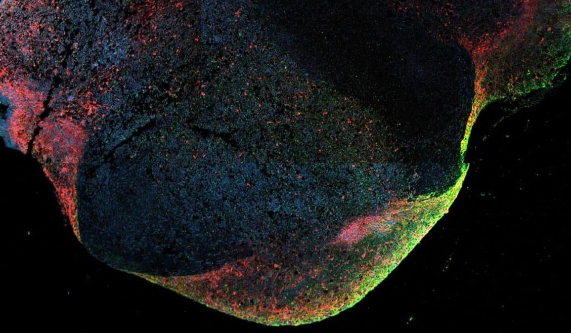 Ebola Maintains Active Persistence Inside Human Brains