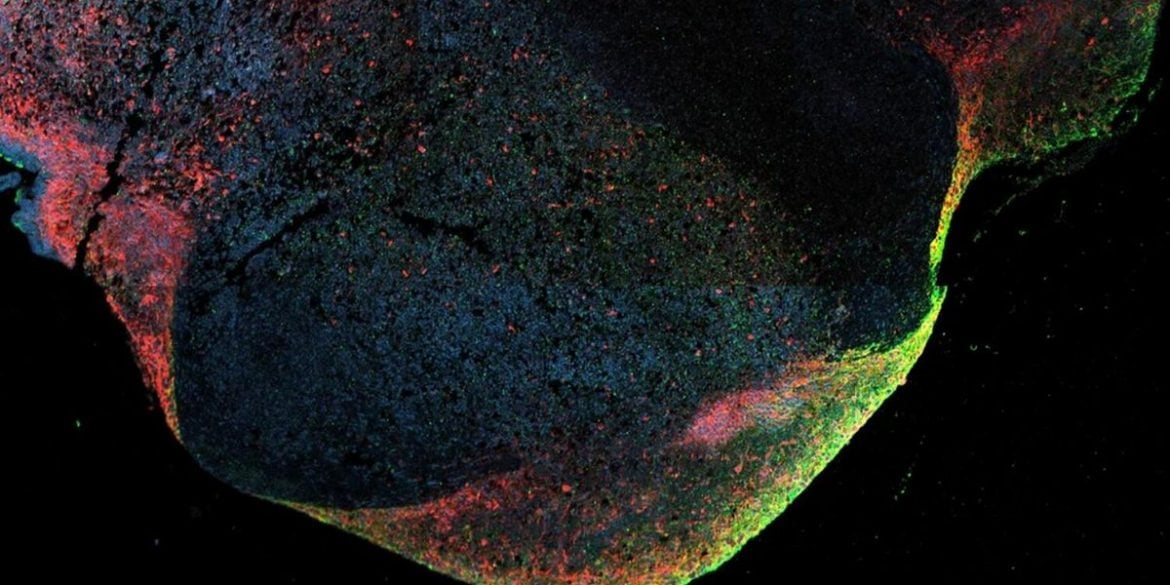 This shows ebola within the brain organoid.