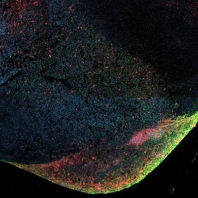 This shows ebola within the brain organoid.