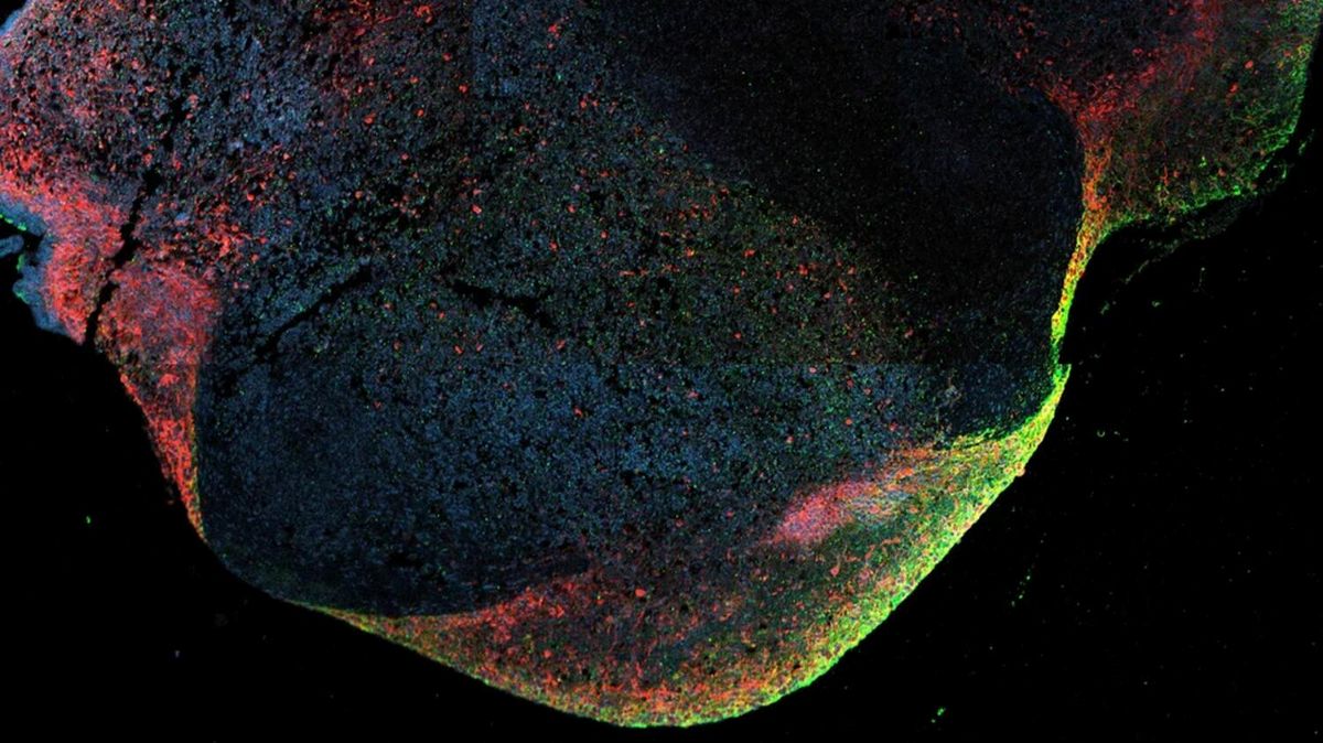 This shows ebola within the brain organoid.