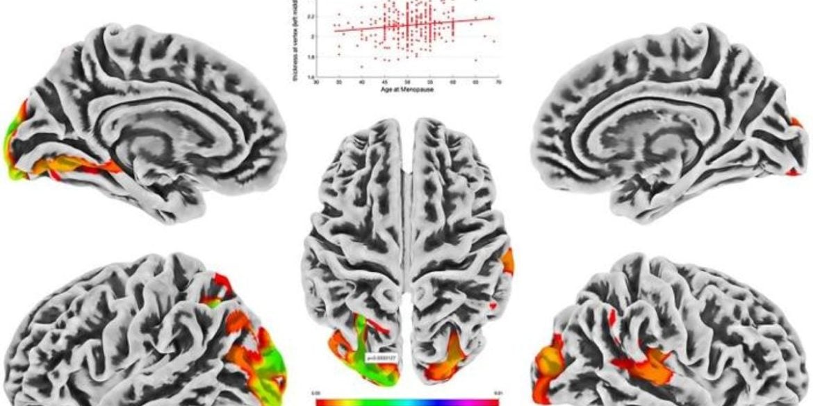 This shows brain scans from the study.