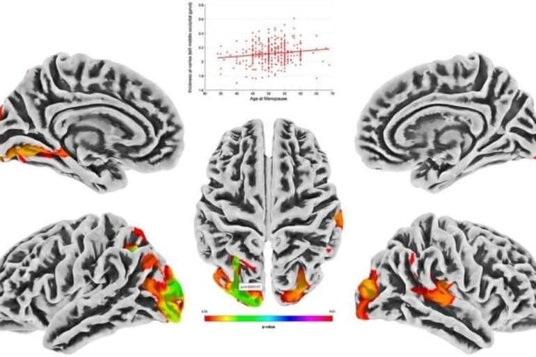 This shows brain scans from the study.