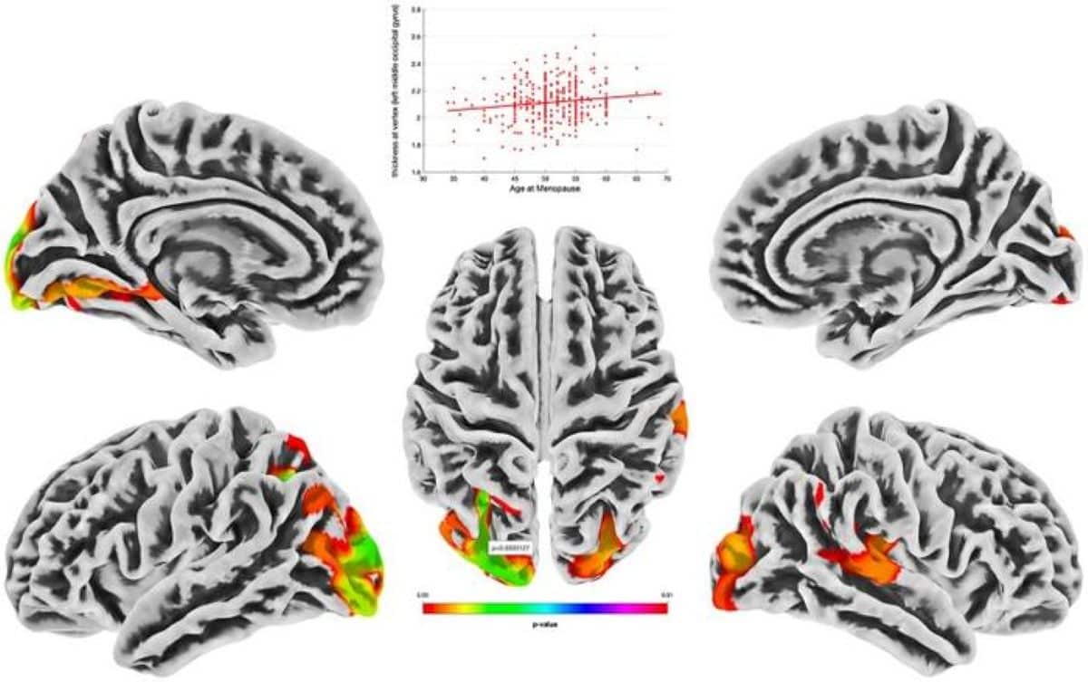 This shows brain scans from the study.