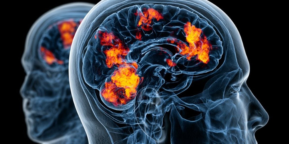 This shows a brain.