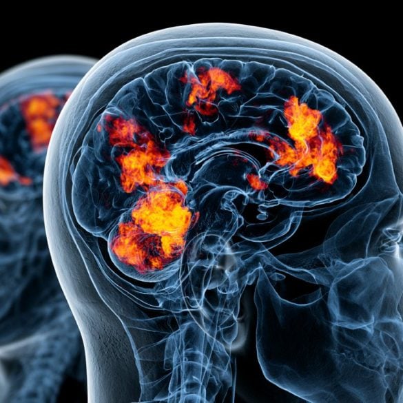 This shows a brain.