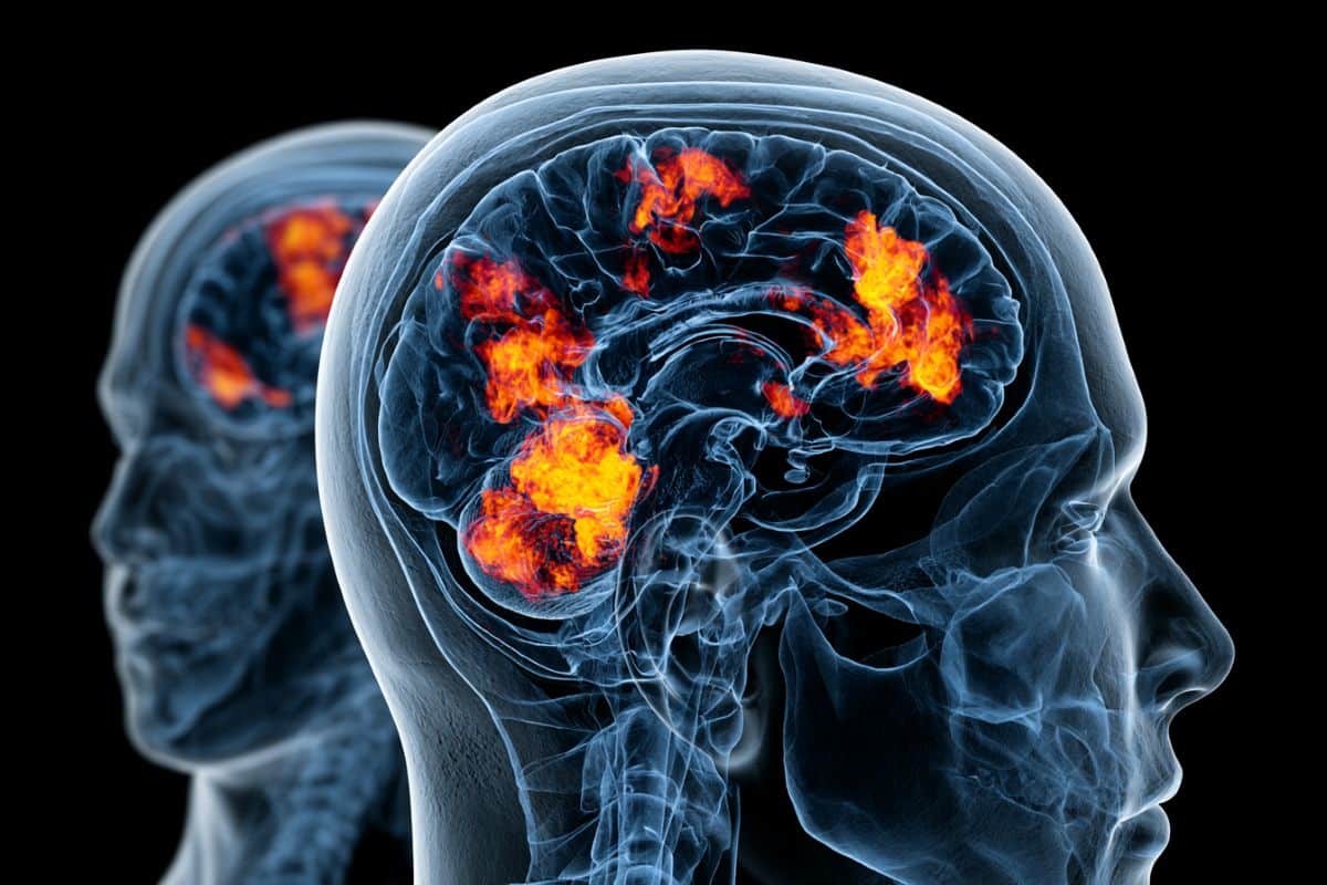This shows a brain.