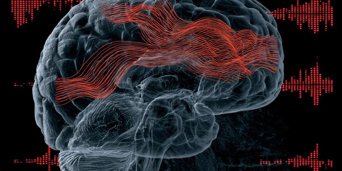 This shows a brain.