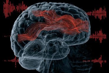 This shows a brain.