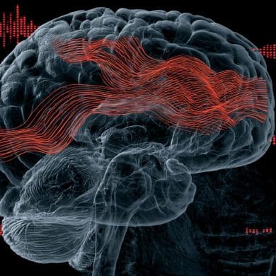 This shows a brain.