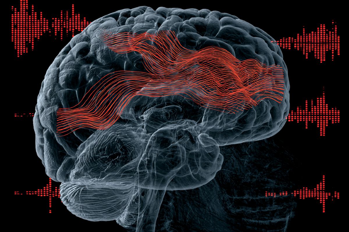 This shows a brain.