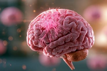 This shows a brain.