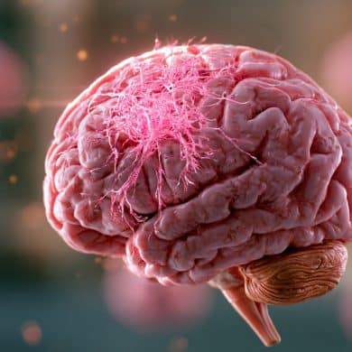 This shows a brain.