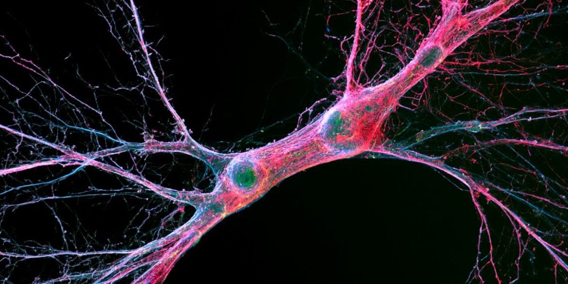 This shows a neuron.