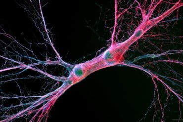 This shows a neuron.