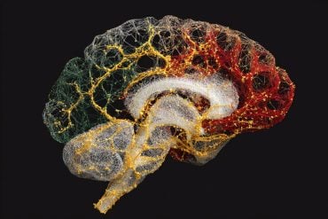 This shows a brain.