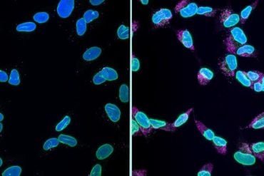 This shows cells undergoing karyoptosis.