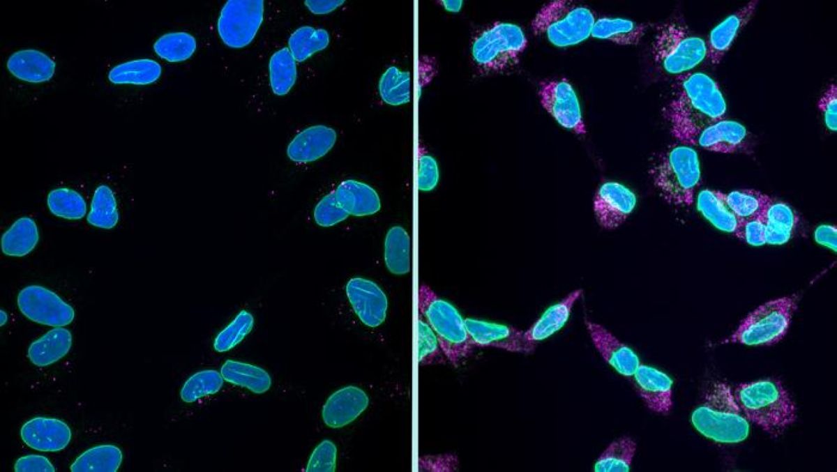 This shows cells undergoing karyoptosis.