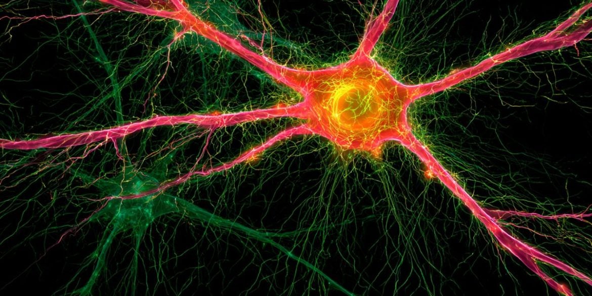 This shows neurons.