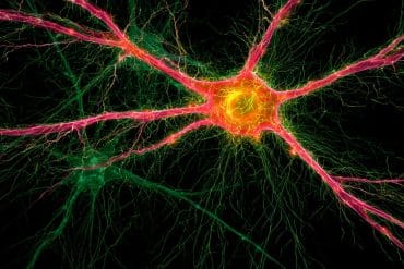 This shows neurons.