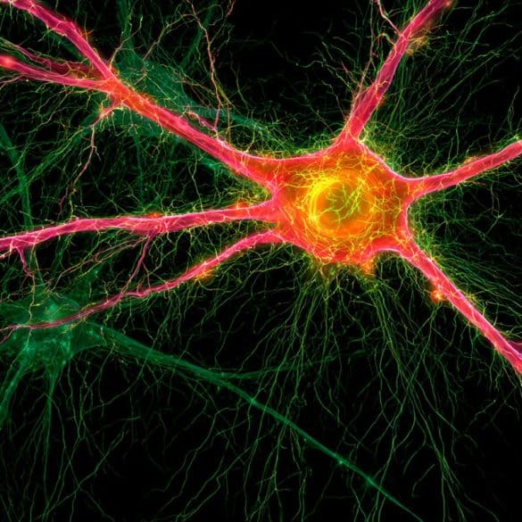 This shows neurons.
