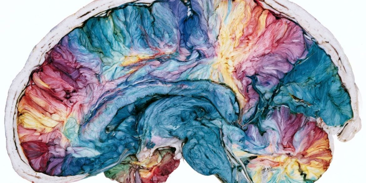 This shows a brain.