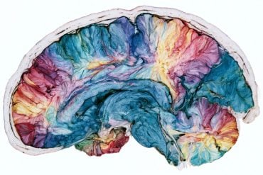This shows a brain.