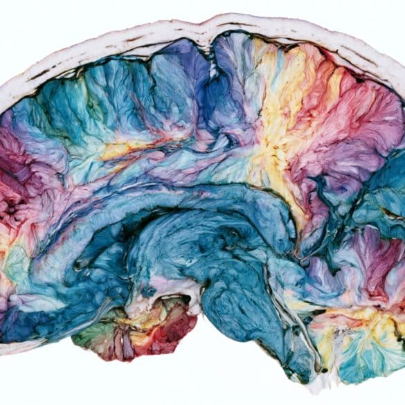 This shows a brain.