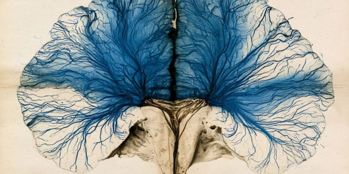 This shows a brain.