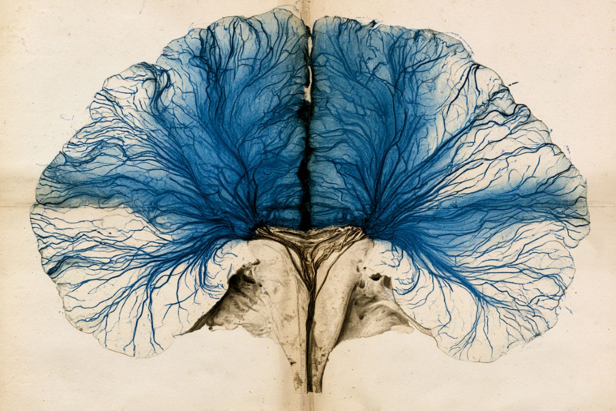 This shows a brain.