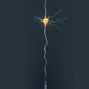 This shows a neuron.