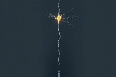 This shows a neuron.