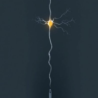 This shows a neuron.
