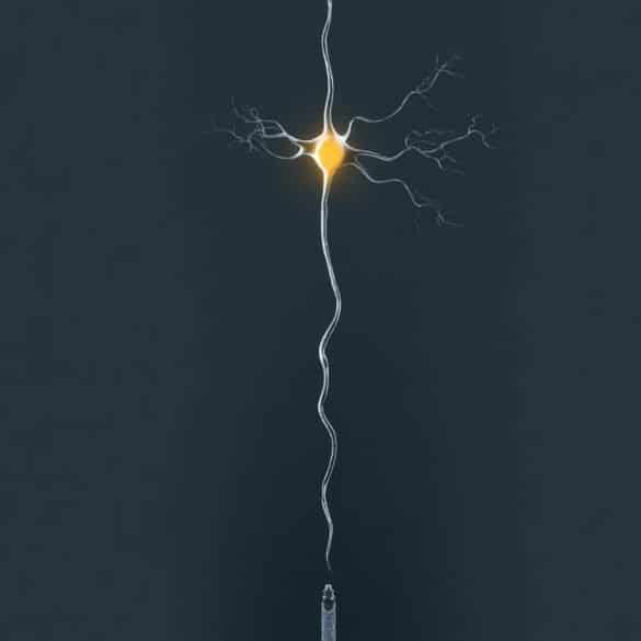 This shows a neuron.