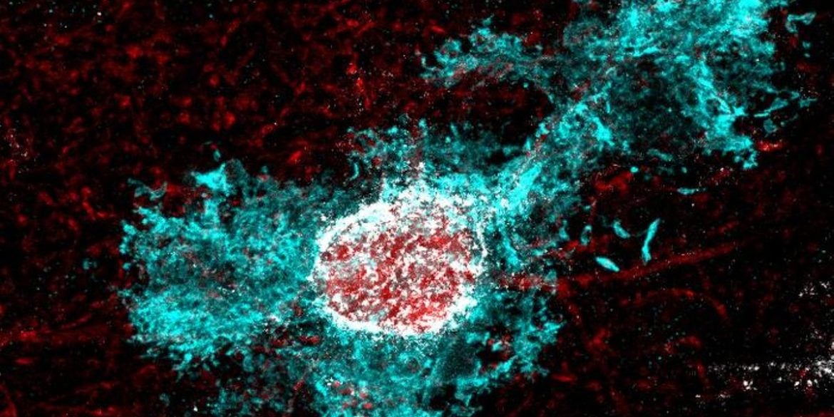 This shows an astrocyte.