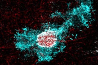 This shows an astrocyte.