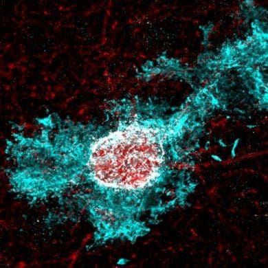 This shows an astrocyte.
